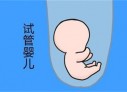 培养大连捐卵宝宝艺术细胞的小技巧